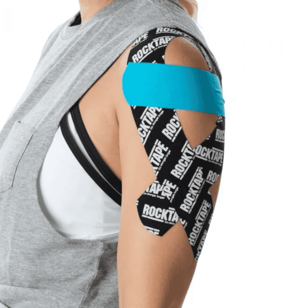 טייפ קיניזיולוגי